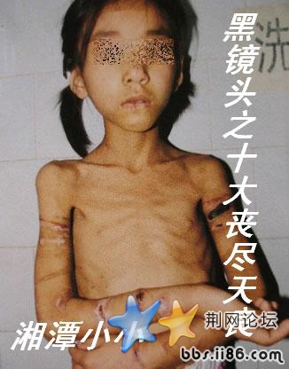 夫妇残忍虐待亲生女 将受伤女儿遗弃涵洞